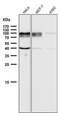 All lanes use the Antibody at 1:2W dilution for 1 hour at room temperature.