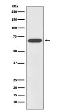 Western blot analysis of SOX11 expression in SHSY5Y cell lysate.