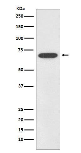 Western blot analysis of SOX11 expression in SHSY5Y cell lysate.