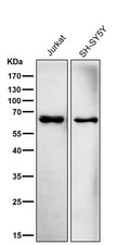 All lanes use the Antibody at 1:5K dilution for 1 hour at room temperature.