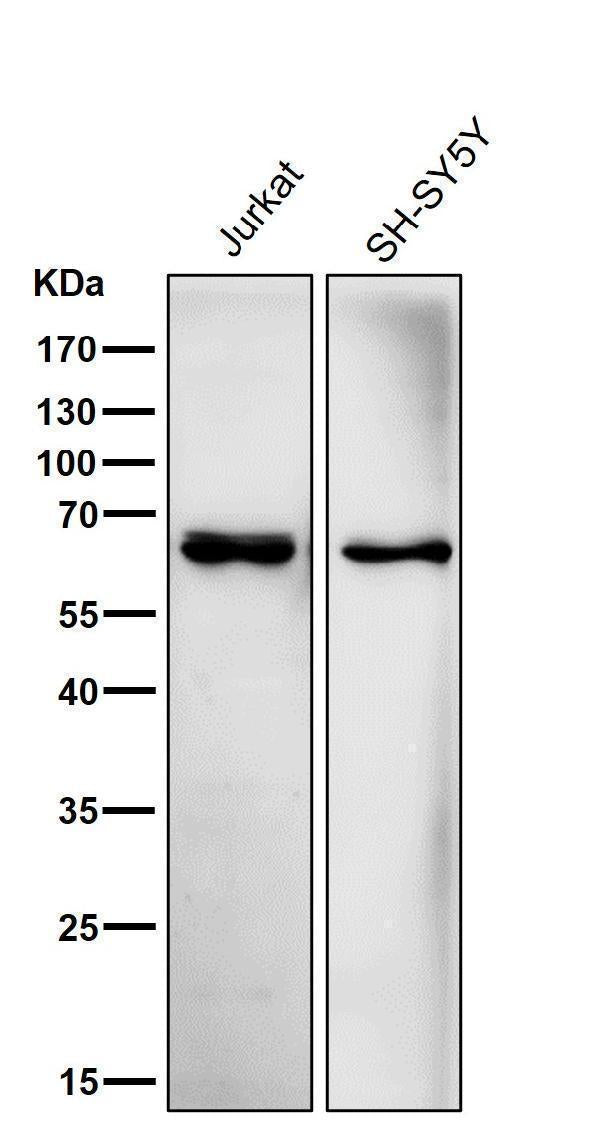 All lanes use the Antibody at 1:5K dilution for 1 hour at room temperature.
