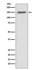 Western blot analysis of ASPP2 expression in MCF7 cell lysate.