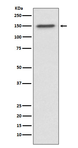Western blot analysis of ASPP2 expression in MCF7 cell lysate.