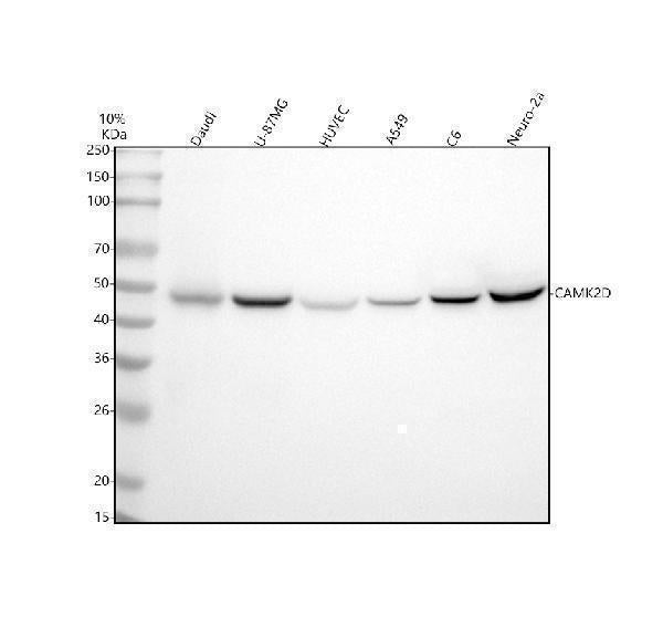 Anti-CaMKII delta CAMK2D Rabbit Monoclonal Antibody