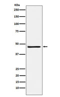 Western blot analysis of FRA2 expression in NCCIT cell lysate.
