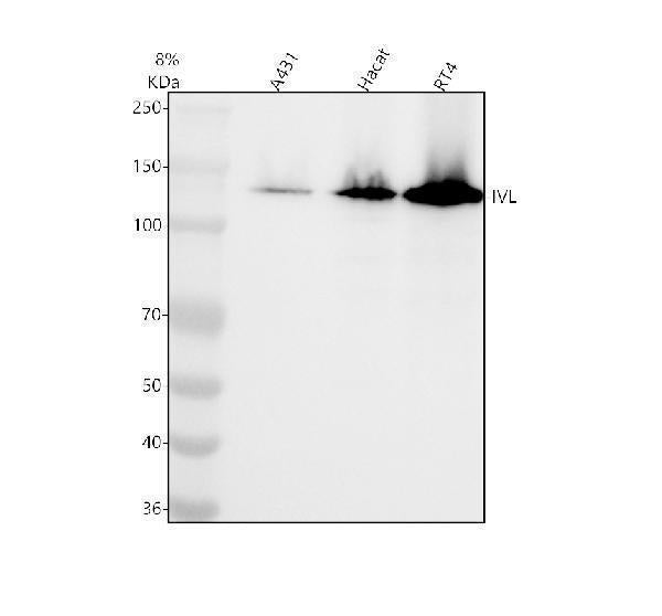 Anti-Involucrin IVL Rabbit Monoclonal Antibody
