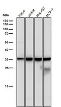 All lanes use the Antibody at 1:1K dilution for 1 hour at room temperature.