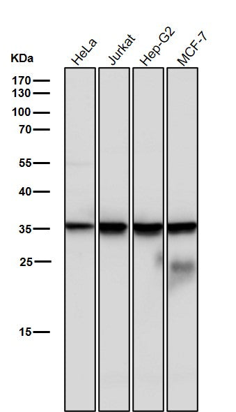 All lanes use the Antibody at 1:1K dilution for 1 hour at room temperature.