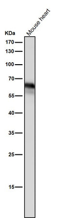 All lanes use the Antibody at 1:3K dilution for 1 hour at room temperature.
