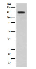 Anti-DSG1/Desmoglein 1 Rabbit Monoclonal Antibody