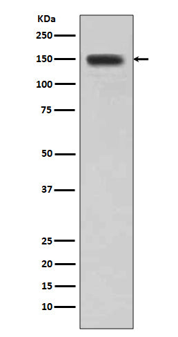 Anti-DSG1/Desmoglein 1 Rabbit Monoclonal Antibody