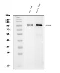 Anti-PDE6 beta/PDE6B Antibody Picoband® (monoclonal, 8I2D7)