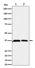 Western blot analysis of Serine racemase expression in (1) 293 cell lysate; (2) U-87 MG cell lysate.