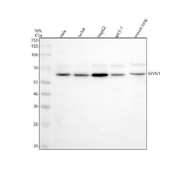 Anti-SYVN1 / HRD1 Rabbit Monoclonal Antibody