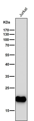 All lanes use the Antibody at 1:1K dilution for 1 hour at room temperature.