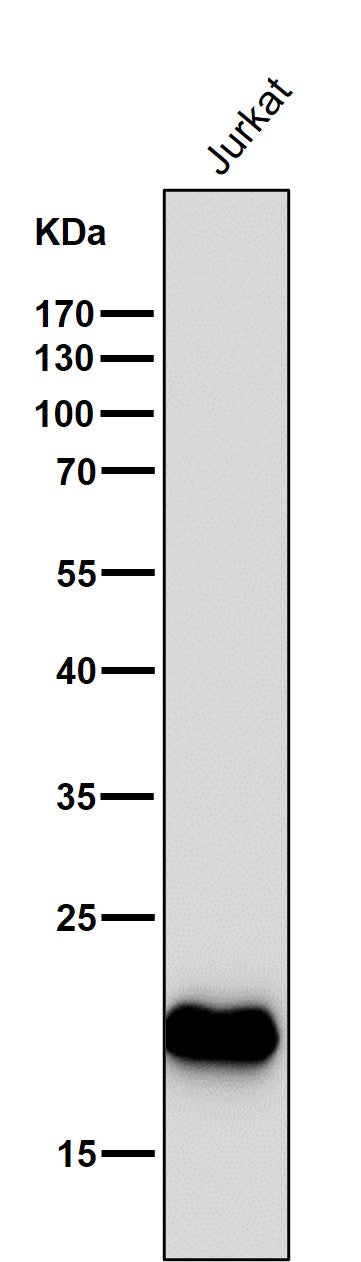 All lanes use the Antibody at 1:1K dilution for 1 hour at room temperature.