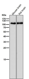 All lanes use the Antibody at 1:1W dilution for 1 hour at room temperature.