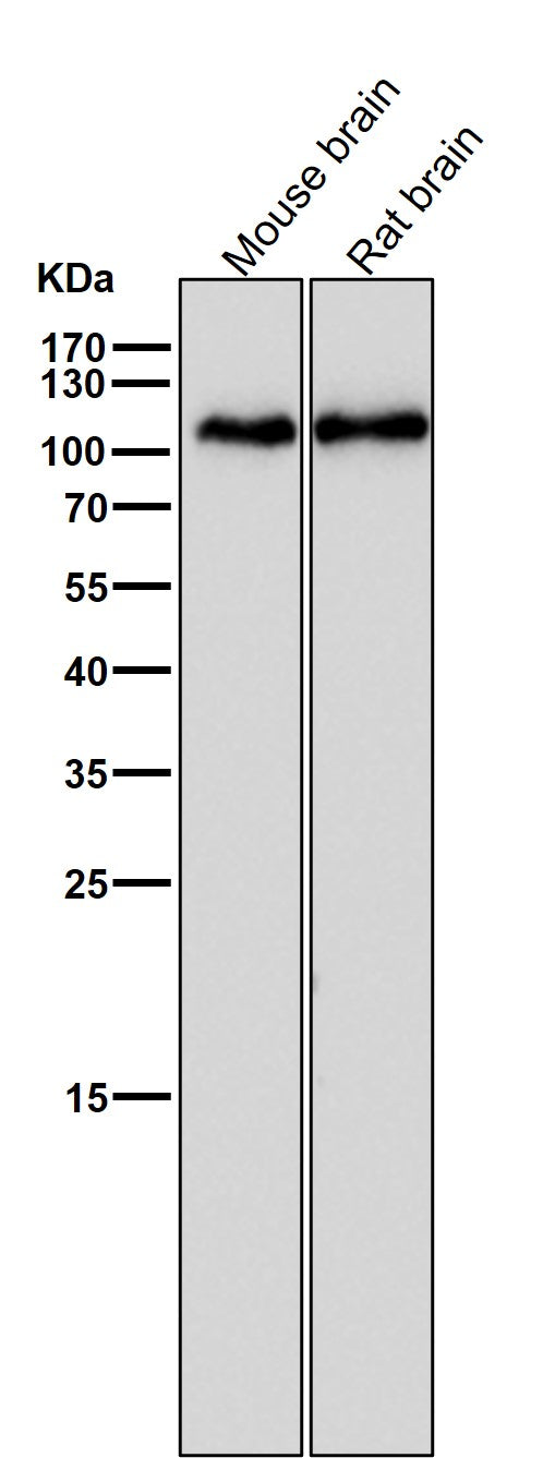 All lanes use the Antibody at 1:1W dilution for 1 hour at room temperature.