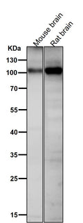 All lanes use the Antibody at 1:1K dilution for 1 hour at room temperature.
