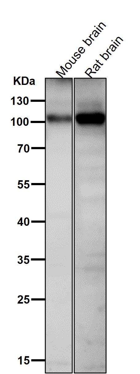 All lanes use the Antibody at 1:1K dilution for 1 hour at room temperature.