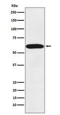 Western blot analysis of STIP1 expression in Jurkat cell lysate.