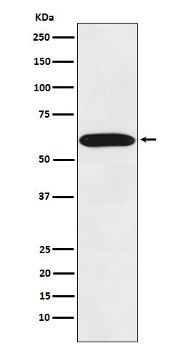 Western blot analysis of STIP1 expression in Jurkat cell lysate.