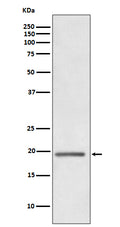 Western blot analysis of HE4 expression in human ovary cancer whole cell lysate.