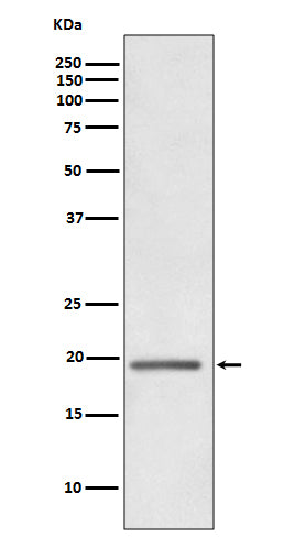 Western blot analysis of HE4 expression in human ovary cancer whole cell lysate.