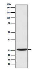 Western blot analysis of Prostaglandin dehydrogenase 1 expression in SW480 cell lysate.