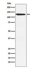 Western blot analysis of SNF2H expression in MCF7 cell lysate.