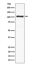 Western blot analysis of ACTN3 expression in mouse skeletal muscle lysate.