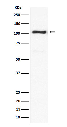 Western blot analysis of ACTN3 expression in mouse skeletal muscle lysate.
