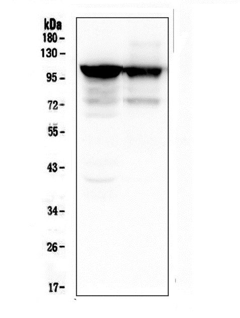 Anti-ACTN3 Antibody Picoband® (monoclonal, 9B5)