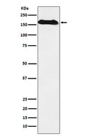 Western blot analysis of NAIP expression in Human fetal kidney lysate.