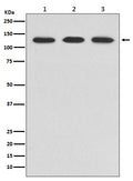 Western blot analysis of ABL2 expression in (1) HeLa cell lysate; (2) NIH/3T3 cell lysate; (3) PC-12 cell lysate.