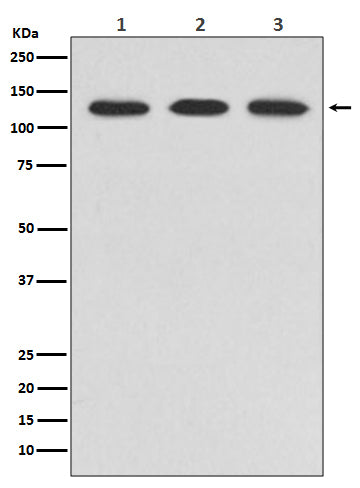 Western blot analysis of ABL2 expression in (1) HeLa cell lysate; (2) NIH/3T3 cell lysate; (3) PC-12 cell lysate.