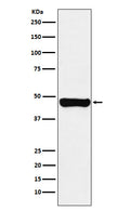 Western blot analysis of RCC1 expression in A431 cell lysate.