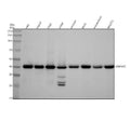 Anti-hnRNP C1/C2 Rabbit Monoclonal Antibody