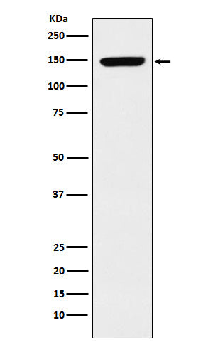 Western blot analysis of p150 CAF1 expression in K562 cell lysate.