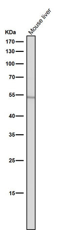 All lanes use the Antibody at 1:1W dilution for 1 hour at room temperature.