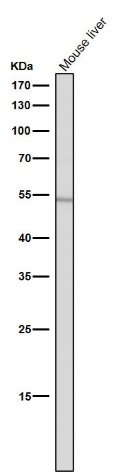 All lanes use the Antibody at 1:1W dilution for 1 hour at room temperature.