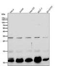 All lanes use the Antibody at 1:1K dilution for 1 hour at room temperature.