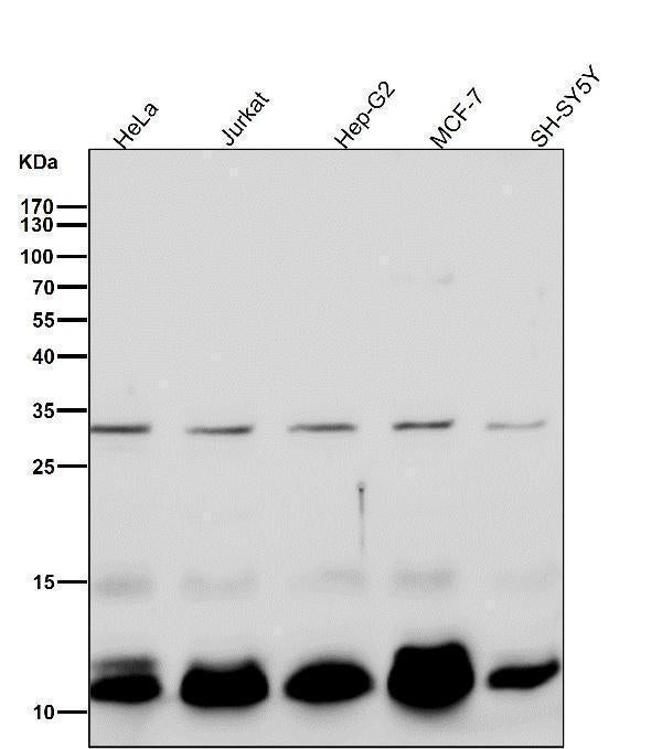 All lanes use the Antibody at 1:1K dilution for 1 hour at room temperature.