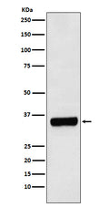 Western blot analysis of PRKRA expression in HepG2 cell lysate.
