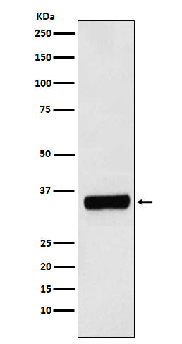 Western blot analysis of PRKRA expression in HepG2 cell lysate.