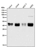 All lanes use the Antibody at 1:1K dilution for 1 hour at room temperature.