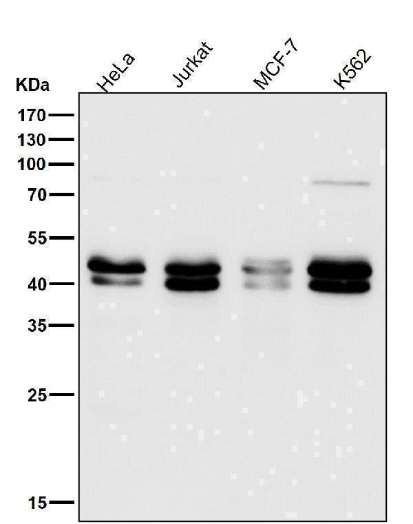 All lanes use the Antibody at 1:1K dilution for 1 hour at room temperature.