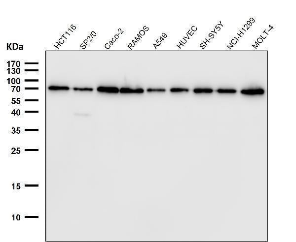 All lanes use Lamin B1 Antibody at 1:10000 dilution for 1 hour at room temperature.