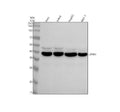 Anti-EDG2 LPAR1 Rabbit Monoclonal Antibody