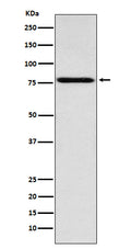 Western blot analysis of Coilin expression in Jurkat cell lysate.
